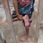 Rescatan a dos niños que eran torturados y amarrados con cadenas