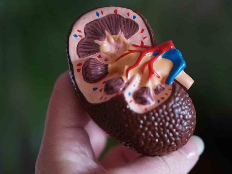 Uno de cada 10 mexicanos con enfermedad renal crónica; más de 12 mil esperan un trasplante
