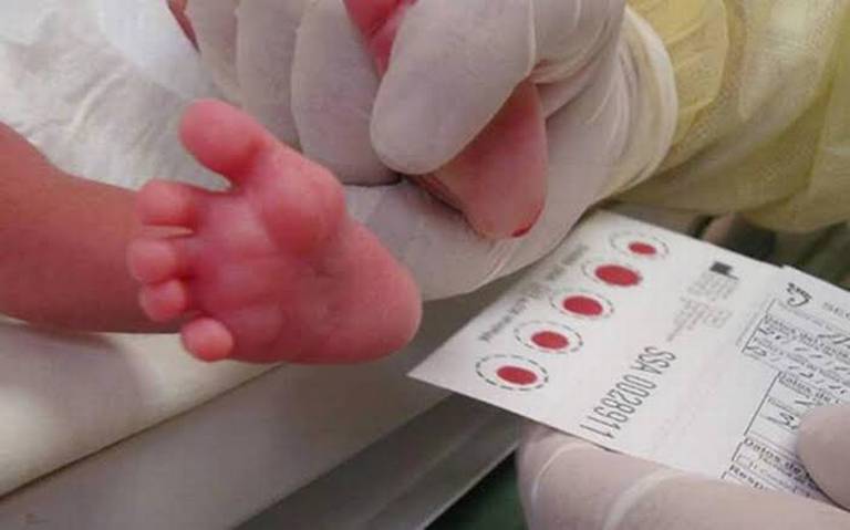 Exhorta IMSS a padres a realizar la prueba de tamiz metabólico neonatal thumbnail