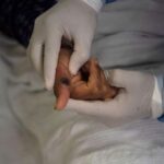 Salud confirma caso importado de viruela del mono en la CDMX; el paciente está aislado y estable